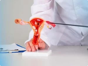 لاپاراسکوپی چیست