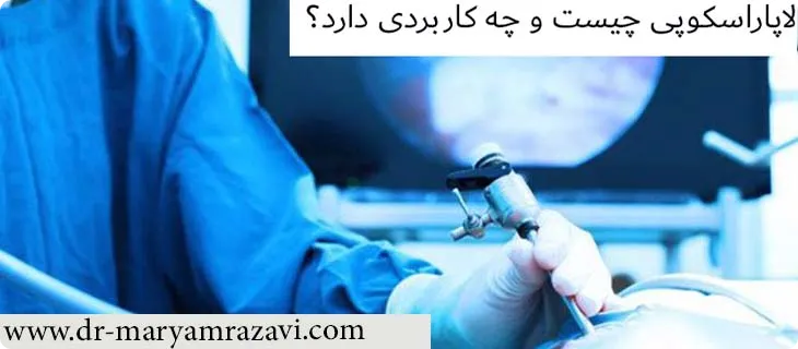 لاپاراسکوپی