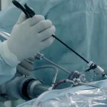 بهترین زمان برقراری رابطه جنسی بعد لاپاراسکوپی