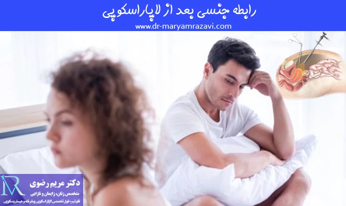 رابطه جنسی بعد از لاپاراسکوپی