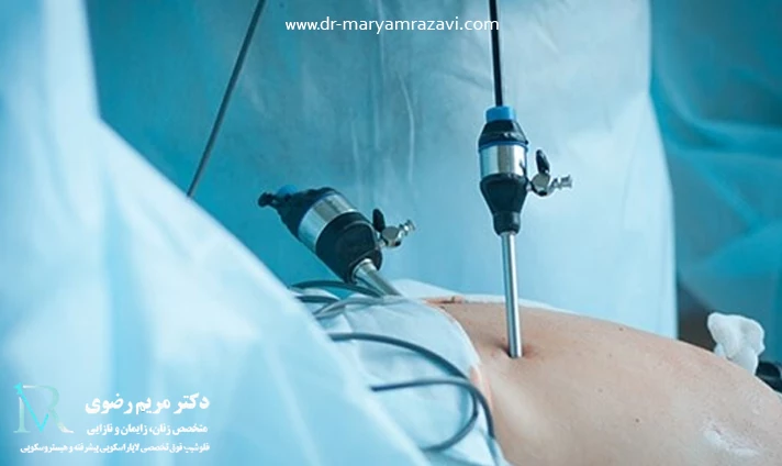 علت ممنوعیت رابطه جنسی بعد از لاپاراسکوپی