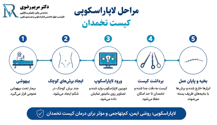 مراحل لاپاراسکوپی کیست تخمدان