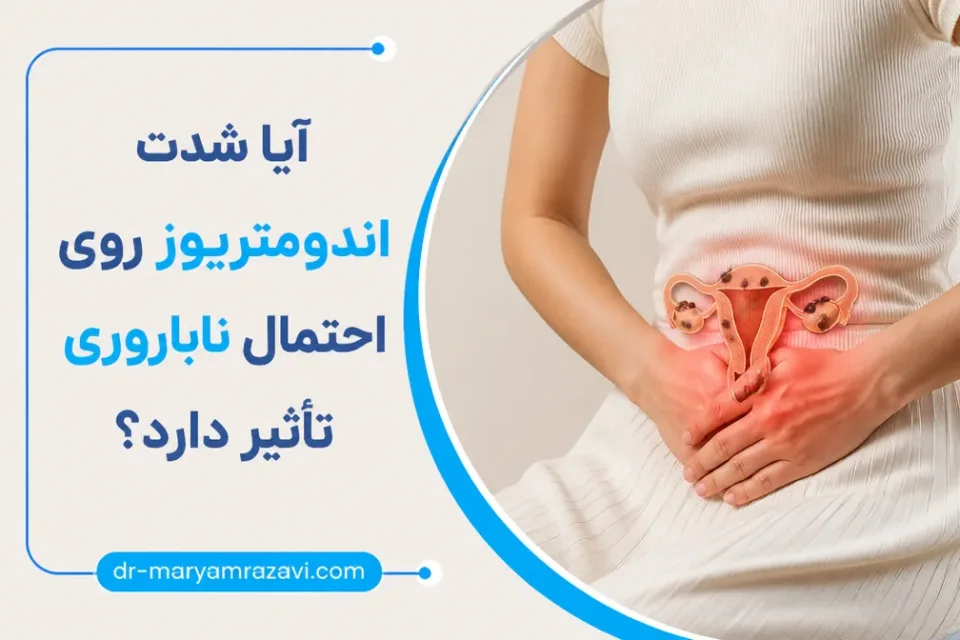 نمای توضیحی درباره آیا شدت اندومتریوز روی احتمال ناباروری تأثیر دارد