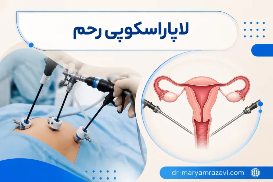 نمای توضیحی درباره لاپاراسکوپی برای برداشتن رحم (هیسترکتومی لاپاراسکوپیک)