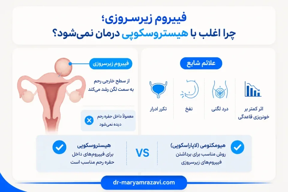 فیبروم زیرسروزی؛ چرا اغلب با هیستروسکوپی درمان نمیشود — مشاوره پزشک برای انتخاب روش درمان فیبروم بر اساس سونوگرافی رحم